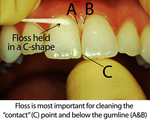 how to use dental floss